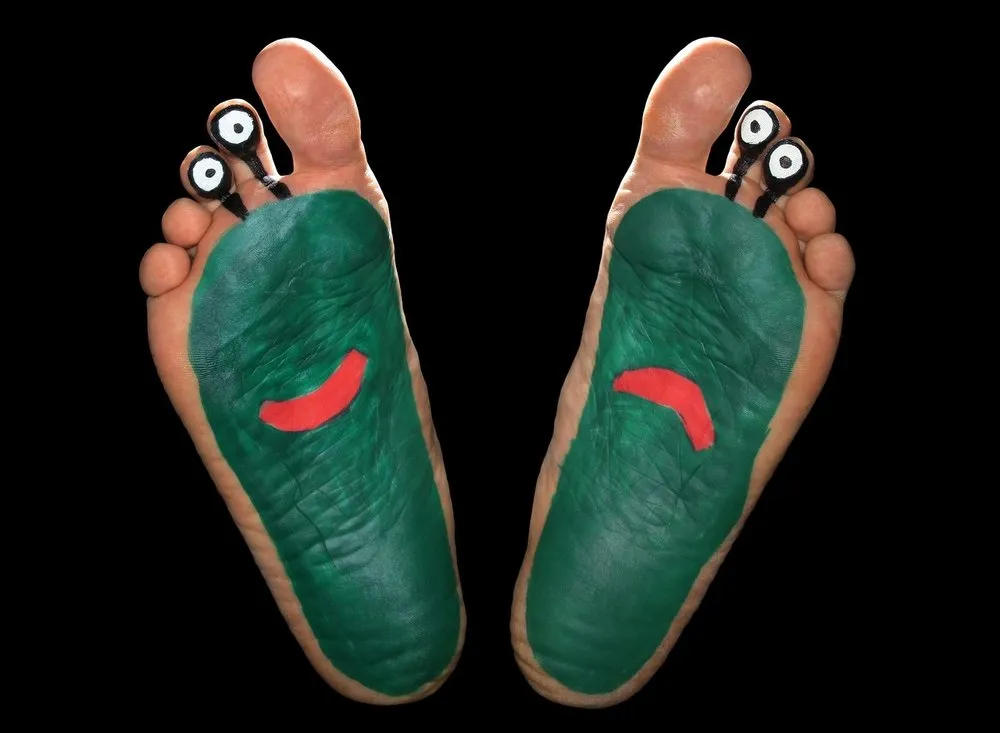 腳氣